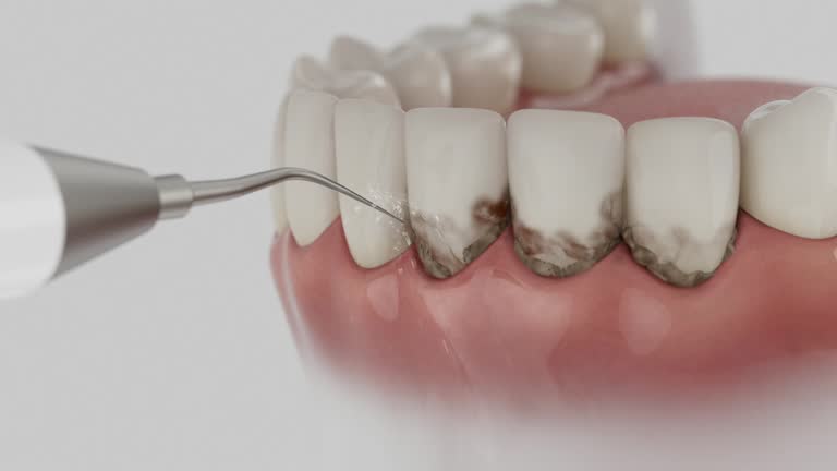 Reliable Dental Implants contractor in Royse City, TX by Smile Center Dentistry
